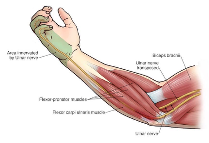 cubital