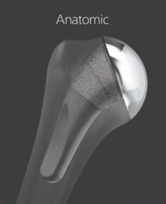 hemiarthroplasty